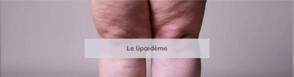 lipo