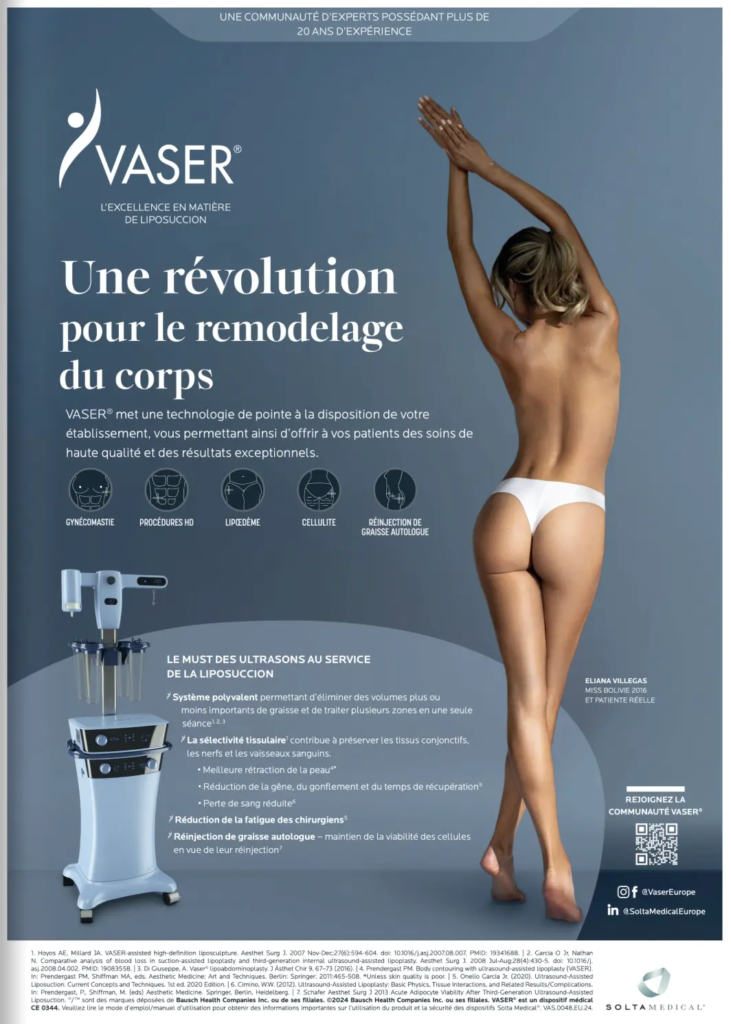 VASER